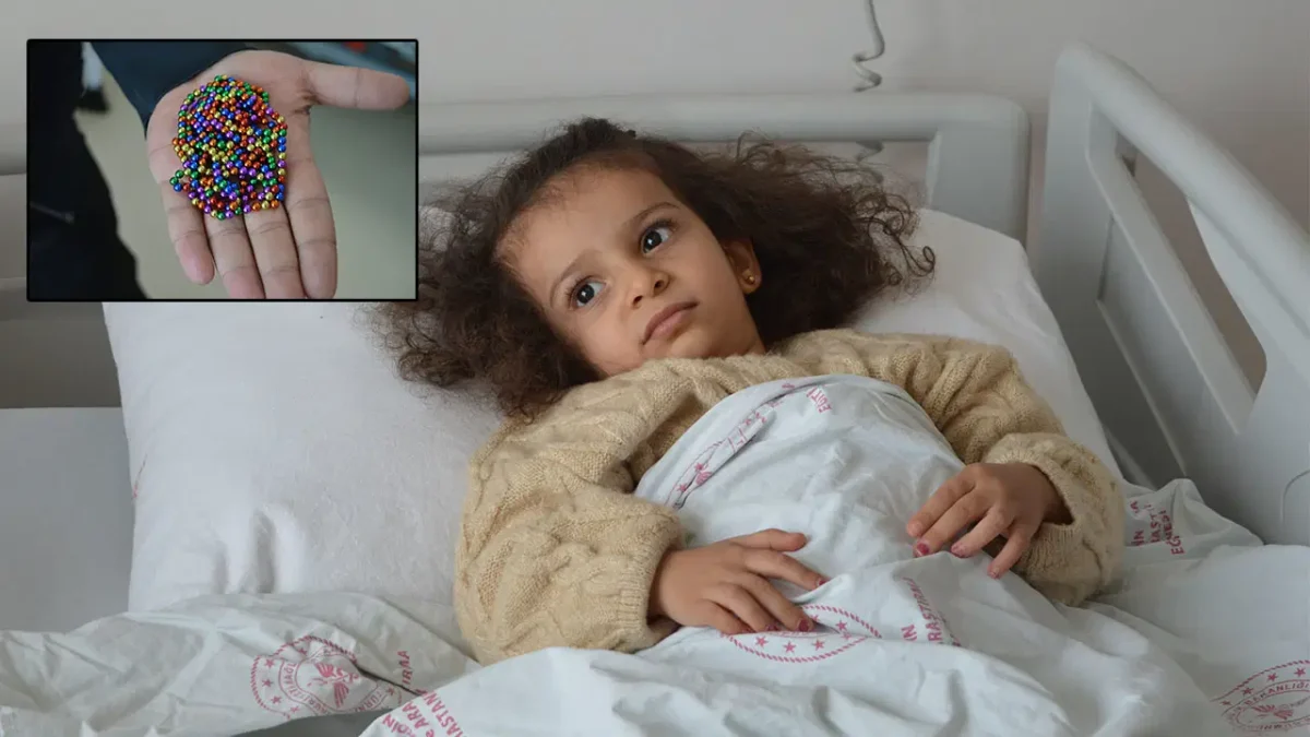 Doktorları şoke eden olay: 4 yaşındaki Eda’nın bağırsağından 8 mıknatıslı boncuk çıktı!