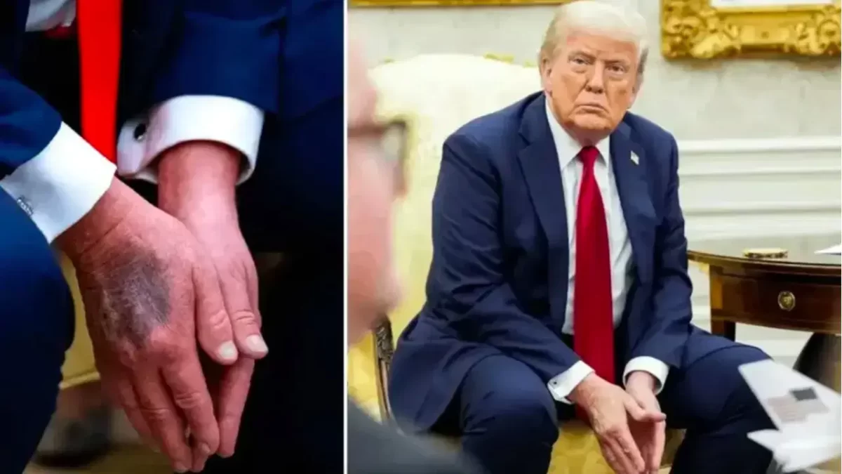 Şişlik ve morarma iddiaları sonrası Trump’ın sağlık raporu açıklandı